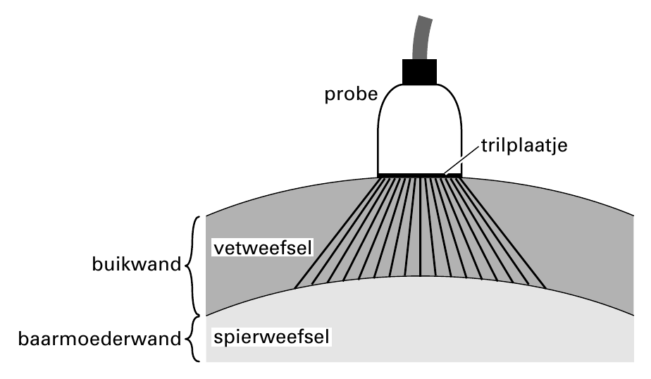 probe trilplaatje vetweefsel buikwand baarmoederwand spierweefsel