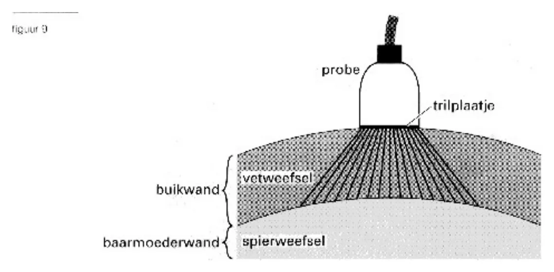 figuur bij de opgave