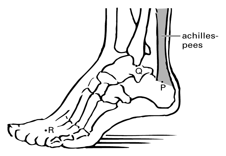achilles- pees Q P R