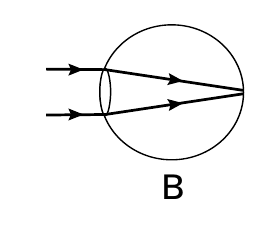 B